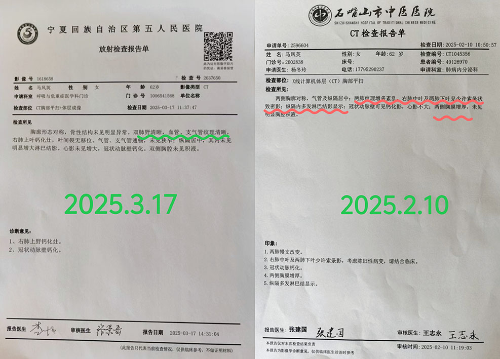 2026072221007715.jpg 灰指甲3.jpg